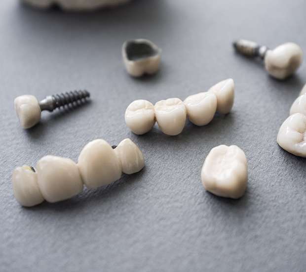 Deerfield Beach The Difference Between Dental Implants and Mini Dental Implants